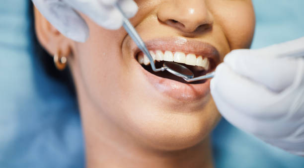 Best Emergency Treatment for Oral Infections in Pelion, SC