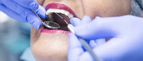 Best Knocked-Out Tooth (Avulsed Tooth) Treatment in Pelion, SC